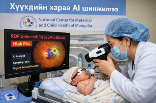 Монгол Улс хүүхдийн харааны өвчнийг AI-аар илрүүлсэн дэлхийн анхны улс боллоо